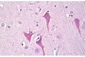 Anti-PKC Mu antibody IHC staining of human brain, cortex neurons. (PKC mu Antikörper  (AA 171-220))