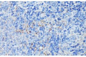 Immunohistochemistry of paraffin-embedded Rat spleen using CR2 Polyclonal Antibody at dilution of 1:100 (40x lens). (CD21 Antikörper)