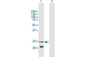 Western Blot analysis of PEMT expression in transfected 293T cell line by PEMT MaxPab polyclonal antibody. (PEMT Antikörper  (AA 1-236))
