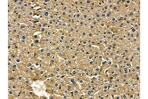 ABIN6257838 and ABIN6275608 at 1/100 staining mouse liver tissue by IHC-P.