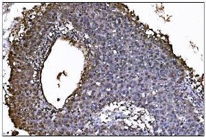 IHC analysis of JAB1 using anti-JAB1 antibody (ABIN7602482).