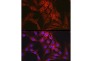 Immunofluorescence analysis of NIH-3T3 cells using Mineralocorticoid receptor (NR3C2) Rabbit pAb (ABIN1681109, ABIN3017672, ABIN3017673 and ABIN6220207) at dilution of 1:100 (40x lens). (NR3C2 Antikörper  (C-Term))