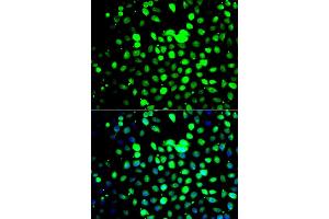 Immunofluorescence analysis of A549 cells using ZBTB25 antibody (ABIN5975302). (ZBTB25 Antikörper)