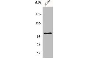 Western Blot analysis of HuvEc cells using mGluR-7 Polyclonal Antibody (GRM7 Antikörper  (C-Term))