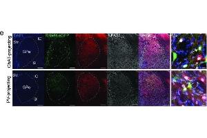 Immunofluorescence (Paraffin-embedded Sections) (IF (p)) image for anti-Neuronal PAS Domain Protein 1 (NPAS1) antibody (ABIN2856208)