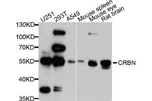 Western blot analysis of extracts of various cell lines, using CRBN antibody (ABIN1876059) at 1:1000 dilution. (CRBN Antikörper)
