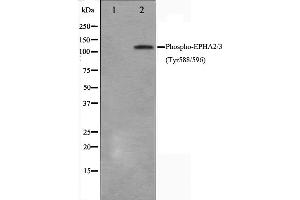 Western blot analysis on HepG2 cell lysate using Phospho-EPHA2/3(Tyr588/596) Antibody,The lane on the left is treated with the antigen-specific peptide. (EPHA2/3/4 Antikörper  (pTyr588, pTyr596))