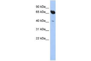 WB Suggested Anti-SCFD1 Antibody Titration: 0. (SCFD1 Antikörper  (N-Term))