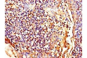 Immunohistochemistry of paraffin-embedded human tonsil tissue using ABIN7158656 at dilution of 1:100 (LEF1 Antikörper  (AA 75-216))