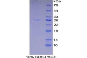 SDS-PAGE analysis of Mouse GSTa4 Protein.