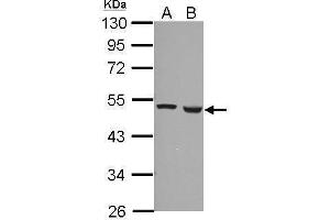 WB Image Sample (30 ug of whole cell lysate) A: A549 B: HCT116 10% SDS PAGE antibody diluted at 1:1000