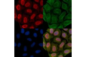 Phospho-EEF1A2 (Ser358) Antibody staining Hela cells(45 min of heat-shock treatment) by IF/ICC.