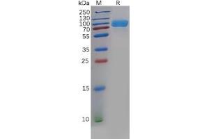 Human B7-H3 Protein, mFc-His Tag on SDS-PAGE under reducing condition. (CD276 Protein (CD276) (mFc-His Tag))