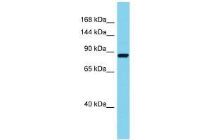 Host: Rabbit Target Name: Stim2 Sample Type: Mouse Pancreas lysates Antibody Dilution: 1. (Stim2 Antikörper  (C-Term))