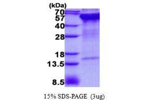 Image no. 1 for Ribophorin II (RPN2) protein (His tag) (ABIN1098507)