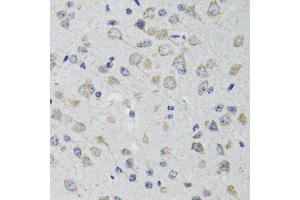 Immunohistochemistry of paraffin-embedded rat brain using HTR3A antibody (ABIN1876848) at dilution of 1:100 (40x lens). (Serotonin Receptor 3A Antikörper)