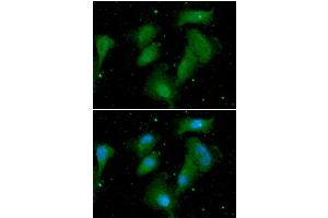 ICC/IF analysis of AKT1/3 in A549 cells. (AKT1/3 Antikörper)