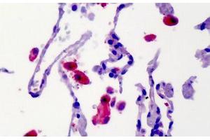 Human Lung: Formalin-Fixed, Paraffin-Embedded (FFPE) (CAMK2B Antikörper)