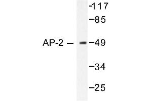 Image no. 1 for anti-Transcription Factor AP-2 alpha (Activating Enhancer Binding Protein 2 Alpha) (TFAP2A) antibody (ABIN265311) (TFAP2A Antikörper)