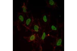 Immunofluorescence analysis of Hela cells using ESR1 mouse mAb (green). (Estrogen Receptor alpha Antikörper)