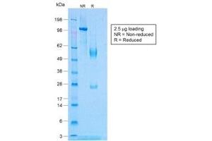 SDS-PAGE analysis of purified, BSA-free recombinant TNFa antibody (clone TNF/1500R) as confirmation of integrity and purity. (TNF alpha Antikörper)