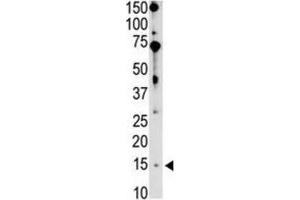 Western Blotting (WB) image for anti-BCL2-Interacting Killer (Apoptosis-Inducing) (BIK) (BH3 Domain) antibody (ABIN2997206) (BIK Antikörper  (BH3 Domain))