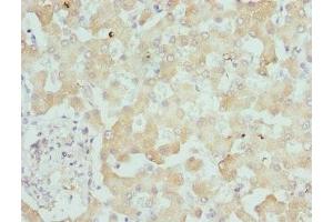 Immunohistochemistry of paraffin-embedded human liver tissue using ABIN7157806 at dilution of 1:100 (DCXR Antikörper  (AA 1-244))