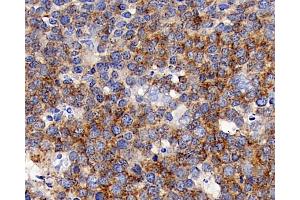 Immunohistochemistry analysis of paraffin-embedded human tonsil using CD192 Polyclonal Antibody at dilution of 1:300. (CCR2 Antikörper)