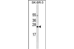 Western blot analysis in SK-BR-3 cell line lysates (35ug/lane). (AGTRAP Antikörper  (C-Term))