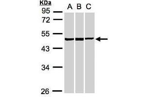 WB Image Sample(30 ug whole cell lysate) A:A431, B:HeLa S3, C:MOLT4 , 10% SDS PAGE antibody diluted at 1:1000 (BZW2 Antikörper)