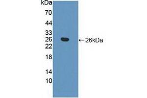Detection of Recombinant APOB, Human using Polyclonal Antibody to Apolipoprotein B (APOB) (APOB Antikörper  (AA 3365-3548))