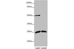 Western blot All lanes: ARHGDIG antibody at 2 μg/mL Lane 1: Mouse brain tissue Lane 2: Mouse lung tissue Secondary Goat polyclonal to rabbit IgG at 1/10000 dilution Predicted band size: 25 kDa Observed band size: 25, 50 kDa (ARHGDIG Antikörper  (AA 1-225))