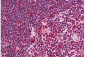 Human Thymus (formalin-fixed, paraffin-embedded) stained with SNW1 antibody ABIN214517 at 5 ug/ml followed by biotinylated goat anti-rabbit IgG secondary antibody ABIN481713, alkaline phosphatase-streptavidin and chromogen. (SNW1 Antikörper  (C-Term))