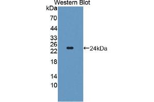 Detection of Recombinant TWSG1, Human using Polyclonal Antibody to Twisted Gastrulation Protein Homolog 1 (TWSG1) (TWSG1 Antikörper  (AA 26-223))