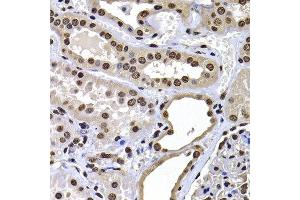 Immunohistochemistry of paraffin-embedded human kidney using H2AFY antibody at dilution of 1:100 (x400 lens). (H2AFY Antikörper)