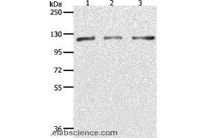 Western blot analysis of Hela, K562 and Jurkat cell, using PARP1 Polyclonal Antibody at dilution of 1:350 (PARP1 Antikörper)
