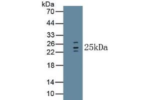 Western Blotting (WB) image for anti-Interleukin 1 Receptor Antagonist (IL1RN) (AA 26-177) antibody (ABIN7428806)