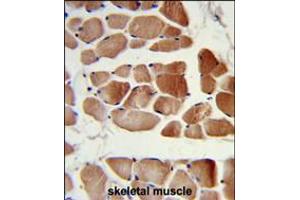Formalin-fixed and paraffin-embedded human skeletal muscle reacted with RUVBL1 Antibody, which was peroxidase-conjugated to the secondary antibody, followed by DAB staining. (RUVBL1 Antikörper)