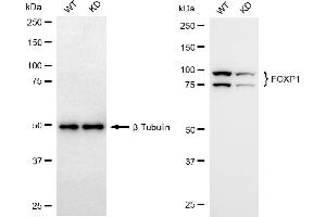 Western blotting analysis using FOXP1 antibody (ABIN7798652). (Rekombinanter FOXP1 Antikörper)