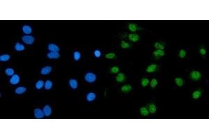 IF analysis of RNF20 using anti-RNF20 antibody (ABIN7599860).