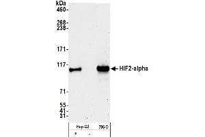 anti-Endothelial PAS Domain Protein 1 (EPAS1) (AA 400-450) antibody