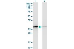 Western Blot analysis of TCEAL1 expression in transfected 293T cell line by TCEAL1 monoclonal antibody (M01), clone 3B9. (TCEAL1 Antikörper  (AA 1-159))