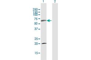 Western Blot analysis of SDPR expression in transfected 293T cell line by SDPR MaxPab polyclonal antibody. (SDPR Antikörper  (AA 1-425))