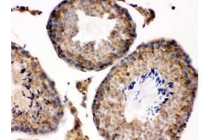 Immunohistochemistry (IHC) image for anti-S100 Calcium Binding Protein A6 (S100A6) (AA 1-90) antibody (ABIN3043320)