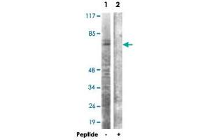 Western blot analysis of extracts from HT-29 cells, using CDC6 polyclonal antibody . (CDC6 Antikörper)