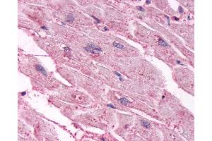Anti-CHRM3 / M3 antibody IHC of human heart. (CHRM3 Antikörper  (C-Term))