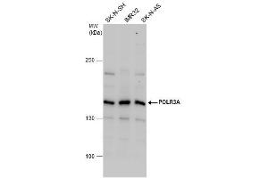 WB Image POLR3A antibody detects POLR3A protein by western blot analysis. (POLR3A Antikörper  (N-Term))