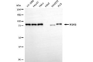Western blotting analysis using IKBKB antibody (ABIN7799034).