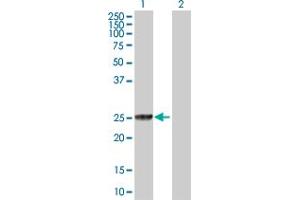 Western Blot analysis of GSTT2 expression in transfected 293T cell line by GSTT2 MaxPab polyclonal antibody. (GSTT2 Antikörper  (AA 1-244))