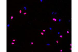 Immunofluorescence analysis of Hela cells(treated with 0. (BrdU Antikörper)
